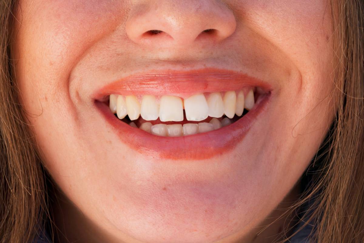 Happy, smile and closeup of woman in city with confidence, pride and joy outdoors for dental wellne